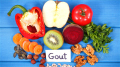 医师:治痛风不能光靠饮食恐脊椎结石而瘫痪(组图)