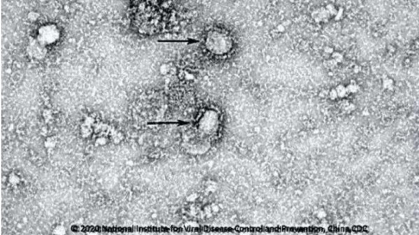 24日，中國疾控中心公布的首株新型冠狀病毒顯微鏡照。