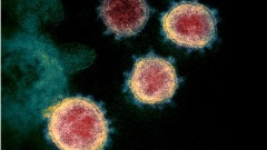 疫情超严重朝鲜秘汇总中共肺炎患者人数(图)