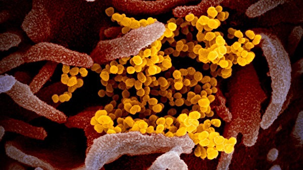 電子顯微鏡下的新型冠状病毒，黃色為新冠病毒，粉紅色是正常細胞