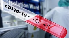 3200萬美政府提供的病毒檢測未用原因…(圖)