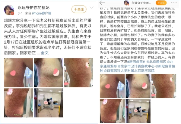 北京市民在微博发文披露自己丈夫在接种国产疫苗后出现的严重过敏反应（图片来源：微博）