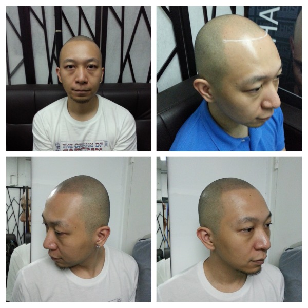 香港百万YouTuber Jason（大J）纹头前（上图）和纹头后（下图）的形象对比。（图片来源：客户提供）