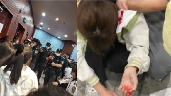 学生维权遭警方暴力镇压，多人头部受伤流血。（图片来源：微博）