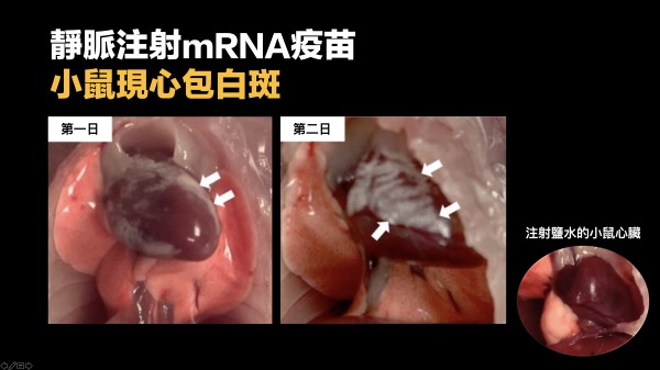 港大研究发现，以静脉注射复必泰mRNA疫苗的小鼠，第一、二日出现明显心肌炎和心包炎。（图片来源：看中国合成图/港大团队图片）