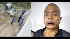 河南官员强拆民宅屋主被打断7根肋骨(图)