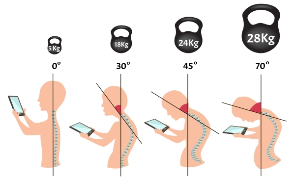 低頭前傾60度看手機時，頸部要承受的重量就高達25～30公斤。