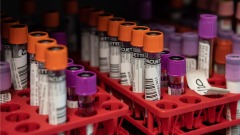 FBI报告：曾在海关拦截藏Mers和Sars活病毒的中国人(组图)