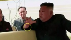 霧裡看花金正恩已處昏迷狀態(圖)