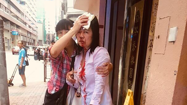 2019年9月24日，香港法輪功學員廖女士（右）向警方申請十一遊行後，在警署外遭兇徒用棍襲擊頭部，受傷送院。（圖片來源：法輪功學員提供）
