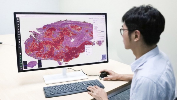 台北醫學大學巨量影像資料庫研究計畫，以AI系統開發肺部腫瘤不需要人工標註的病理影像辨識系統，準確率高達95%以上，且每名病人只須3到5分鐘就可判讀。
