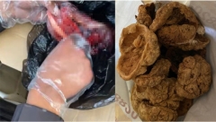 中国人体胎盘交易黑幕：竟从殡仪馆大量流出(图)