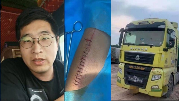 近日，山東卡車司機「被超載」受罰，無奈只得割腕自殘證清白（圖片來源：微博）