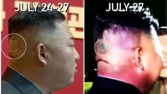 金正恩腦後貼膠布健康狀況惹外界猜測(圖)